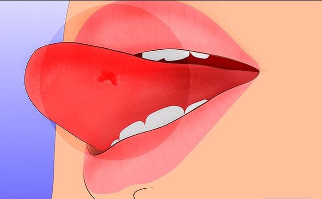 Tại sao cắn lưỡi lại chết?
